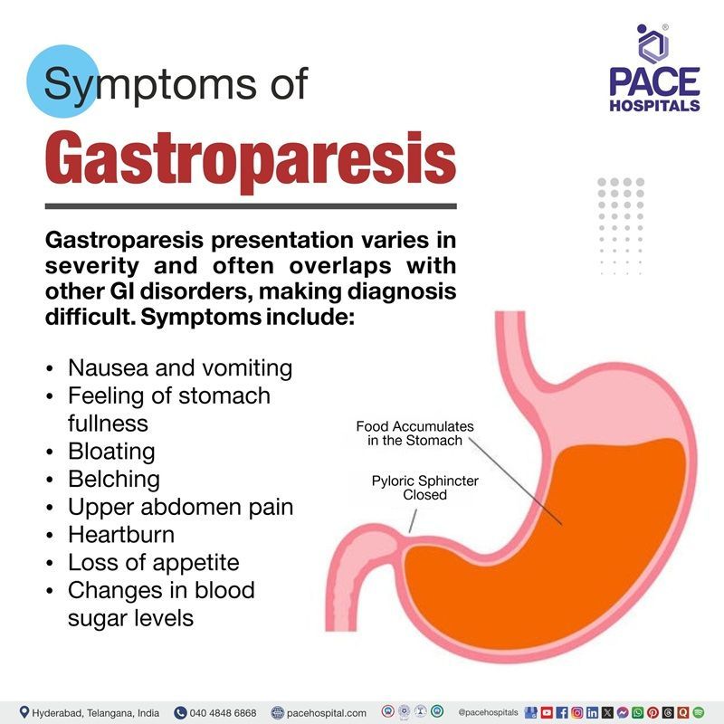 Gastroparesis Symptoms Gastroparesis symptoms | Signs and symptoms of Gastroparesis | Symptoms of Gastroparesis