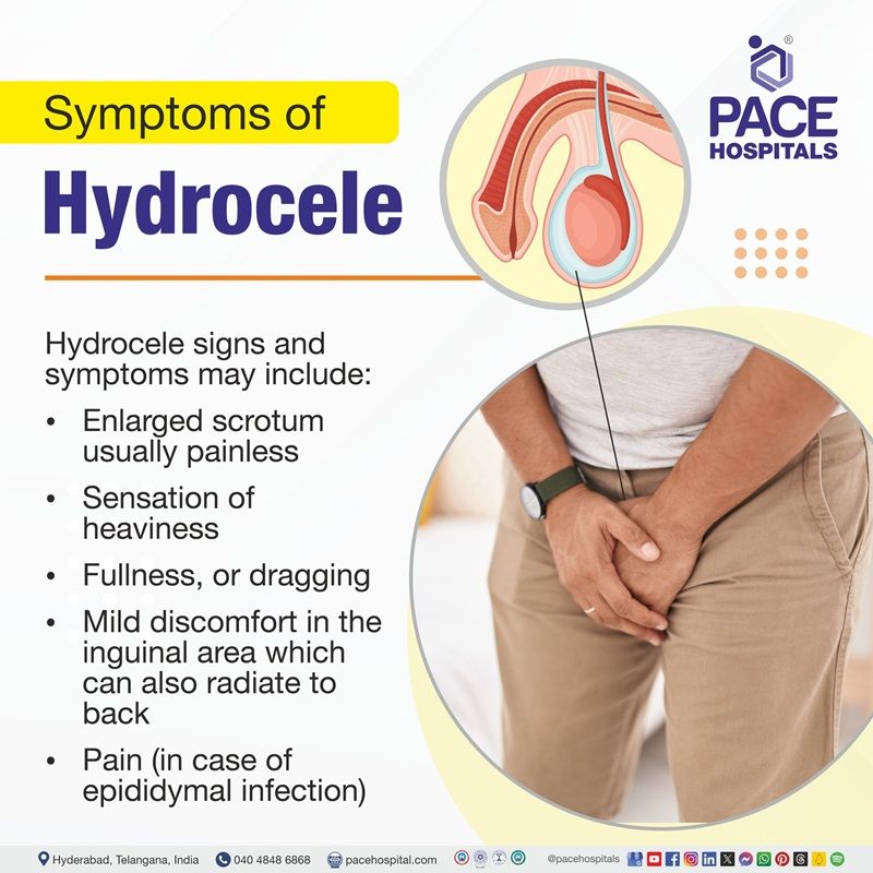 Hydrocele symptoms hydrocele symptoms | hydrocele signs and symptoms | testicular hydrocele symptoms | hydrocele causes symptoms and treatment
