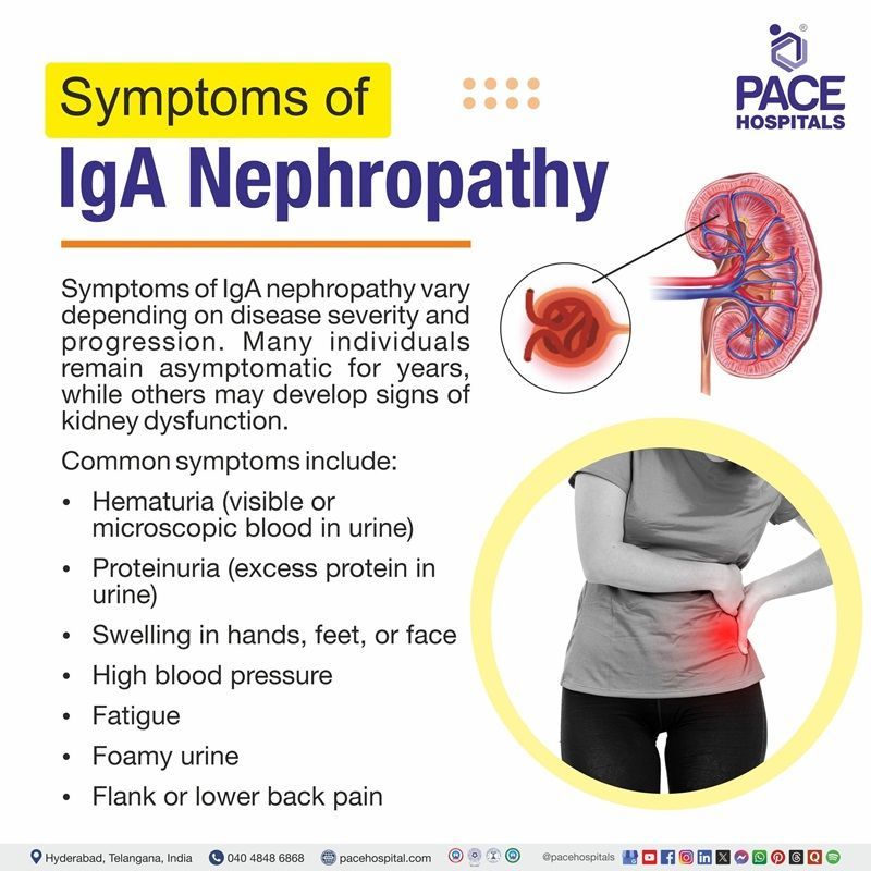 Symptoms of IgA Nephropathy igA nephropathy symptoms | symptoms of igA nephropathy | Visual depicting the symptoms of igA nephropathy