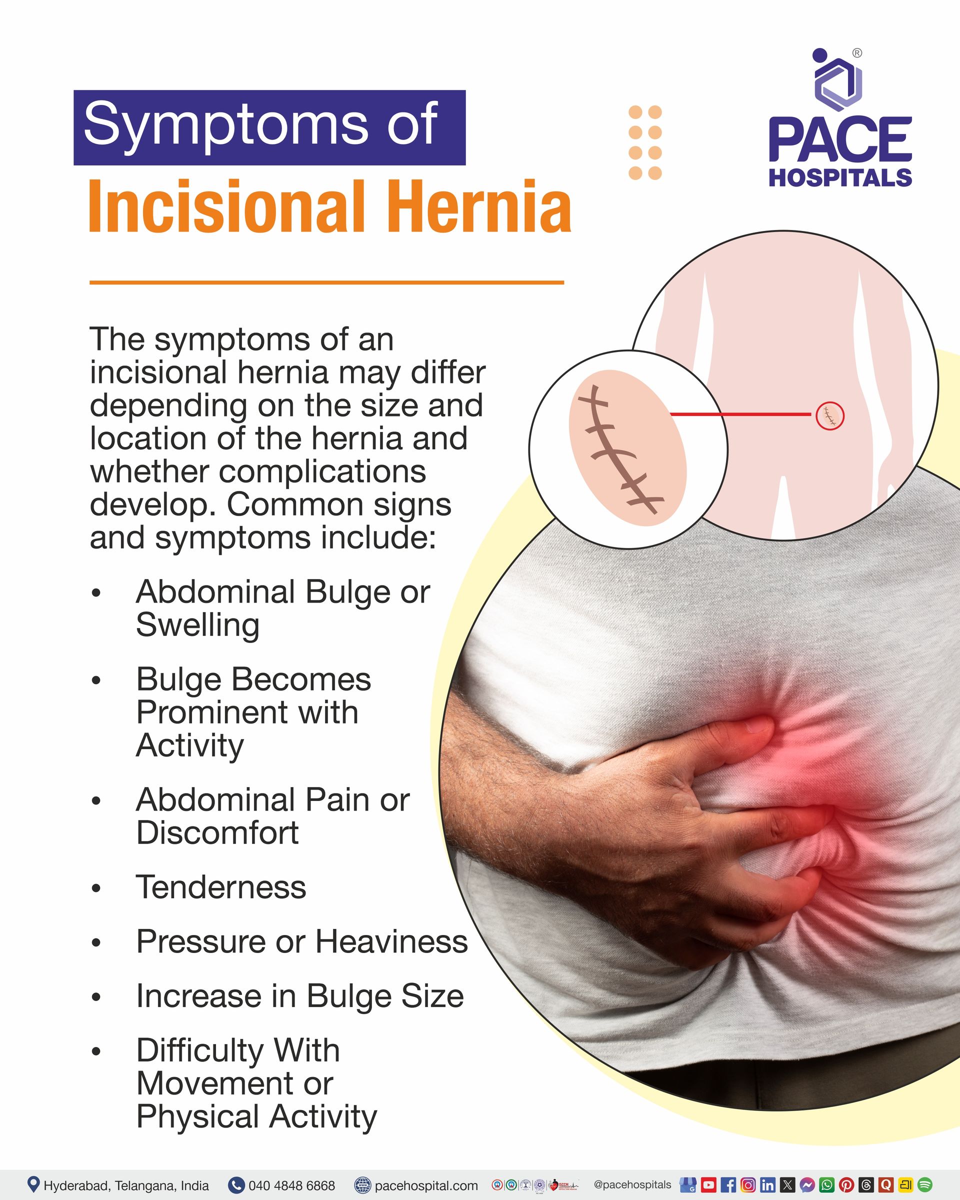Symptoms of Incisional Hernia signs and symptoms incisional hernia I symptoms of incisional hernia in females I incisional hernia symptoms male