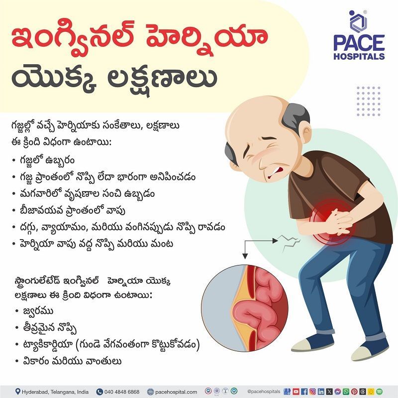 Symptoms of Inguinal hernia in Telugu Symptoms of Inguinal hernia in Telugu | Inguinal hernia Symptoms in Telugu | What are the symptoms of Inguinal hernia in Telugu