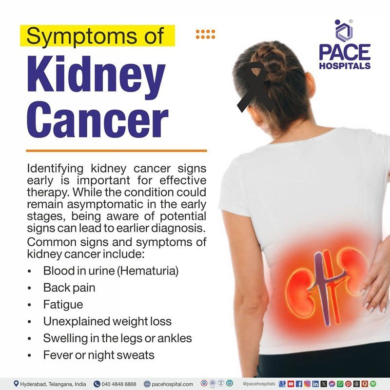 Kidney cancer symptoms Kidney cancer symptoms | Infographic showing the symptoms of Kidney cancer