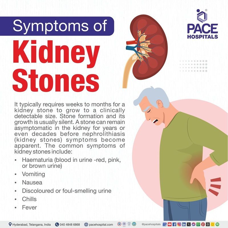 Kidney stones symptoms kidney stone symptoms | kidney stone symptoms in women | kidney stones symptoms female | kidney stone symptoms in men | Visual outlining the symptoms of Kidney stones