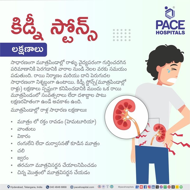 kidney stone symptoms | kidney stone symptoms in women | kidney stones symptoms female | kidney stone symptoms in men | Visual outlining the symptoms of Kidney stones
