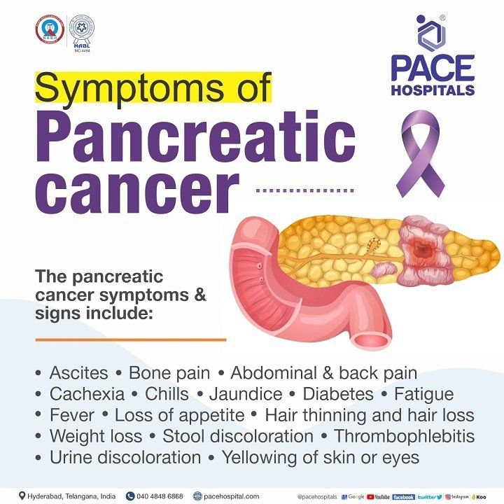 symptoms of pancreatic cancer pancreatic cancer symptoms | signs of pancreatic cancer