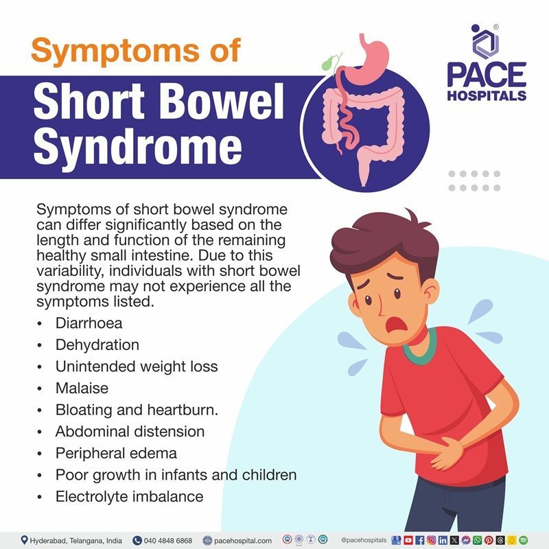 Symptoms of Short bowel syndrome short bowel syndrome symptoms | symptoms of short bowel syndrome | various symptoms of short bowel syndrome | Visual depicting the various symptoms of short bowel syndrome