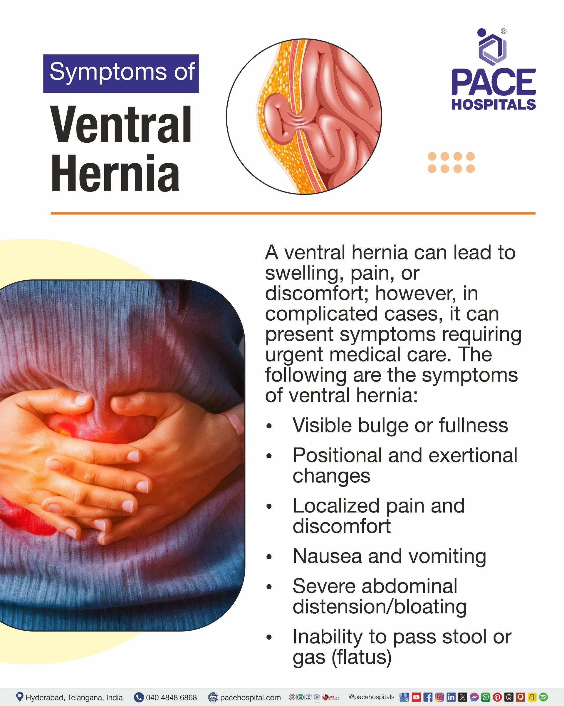 Symptoms of Ventral Hernia ventral hernia symptoms I ventral cord herniation symptoms I ventral hernia recurrence symptoms