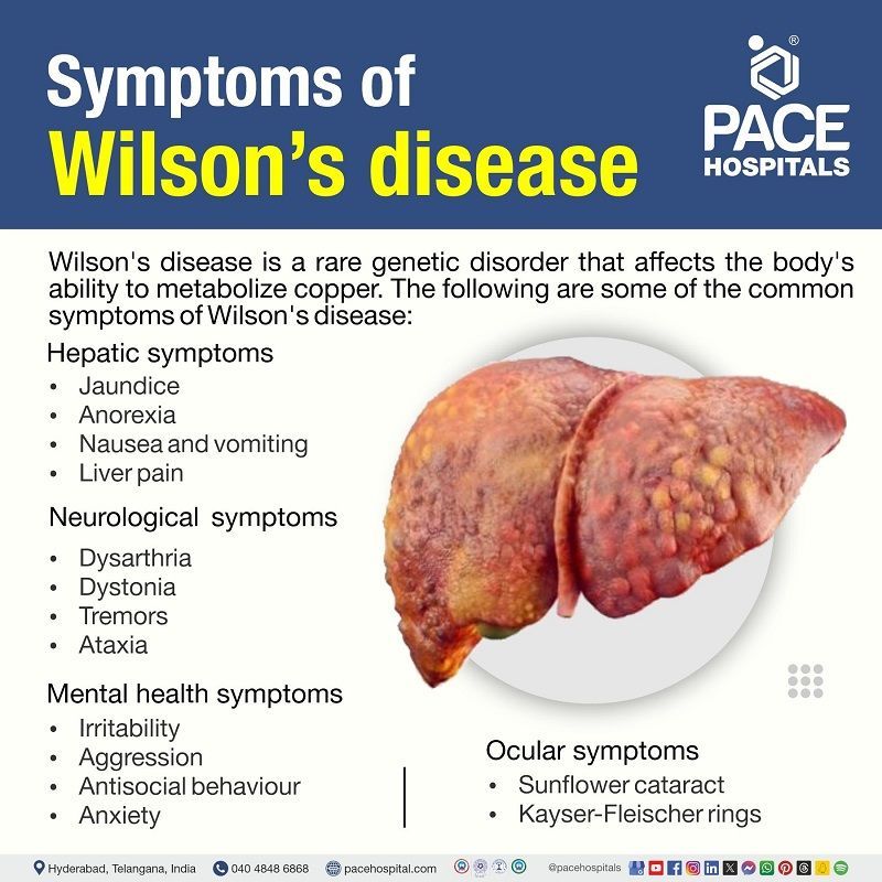 Wilson's Disease Symptoms What are symptoms of Wilson's disease | Wilson's disease symptoms | Neurological symptoms | Visual depicting the symptoms of Wilson's disease and a liver affected by Wilson's disease