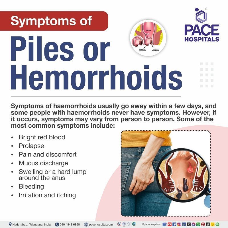 Piles Symptoms piles symptoms | internal piles | symptoms of piles in male and female | symptoms | piles starting symptoms | Visual depicting the symptoms of Piles (Hemorrhoids)
