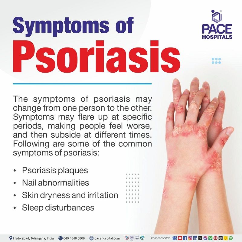Symptoms of Psoriasis psoriasis symptoms | what are the symptoms of psoriasis | psoriasis signs and symptoms | psoriasis symptoms photos | early psoriasis symptoms | Visual depicting the symptoms of Psoriasis