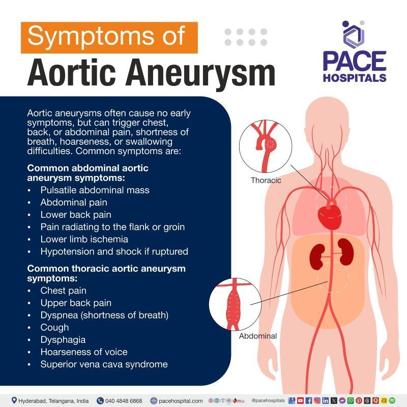 Aortic Aneurysm Symptoms Aortic Aneurysm Symptoms | Early symptoms of aortic aneurysm | Signs and symptoms of aortic aneurysm