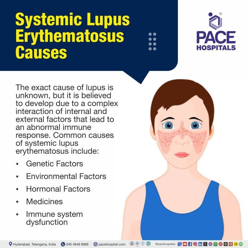 Systemic Lupus Erythematosus Causes Systemic Lupus Erythematosus Causes | What causes lupus | What causes lupus disease