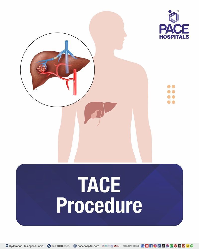 TACE Cost in Hyderabad | Affordable TACE Procedure in India