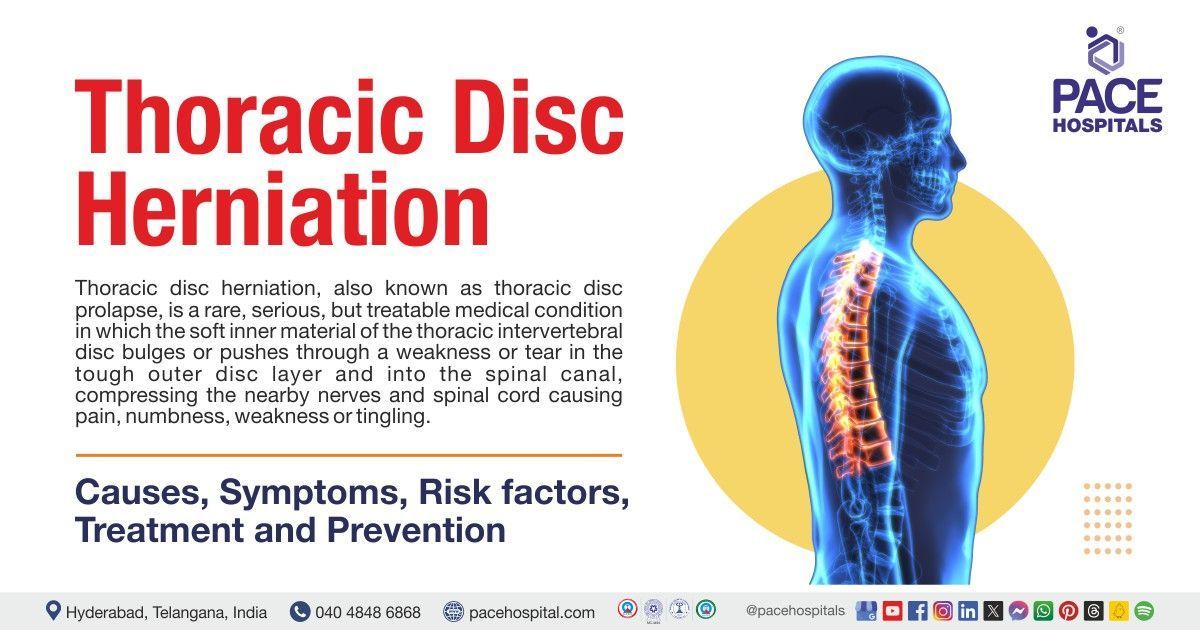 Thoracic disc herniation: Symptoms, Causes and Preventions | disc herniation treatment in India