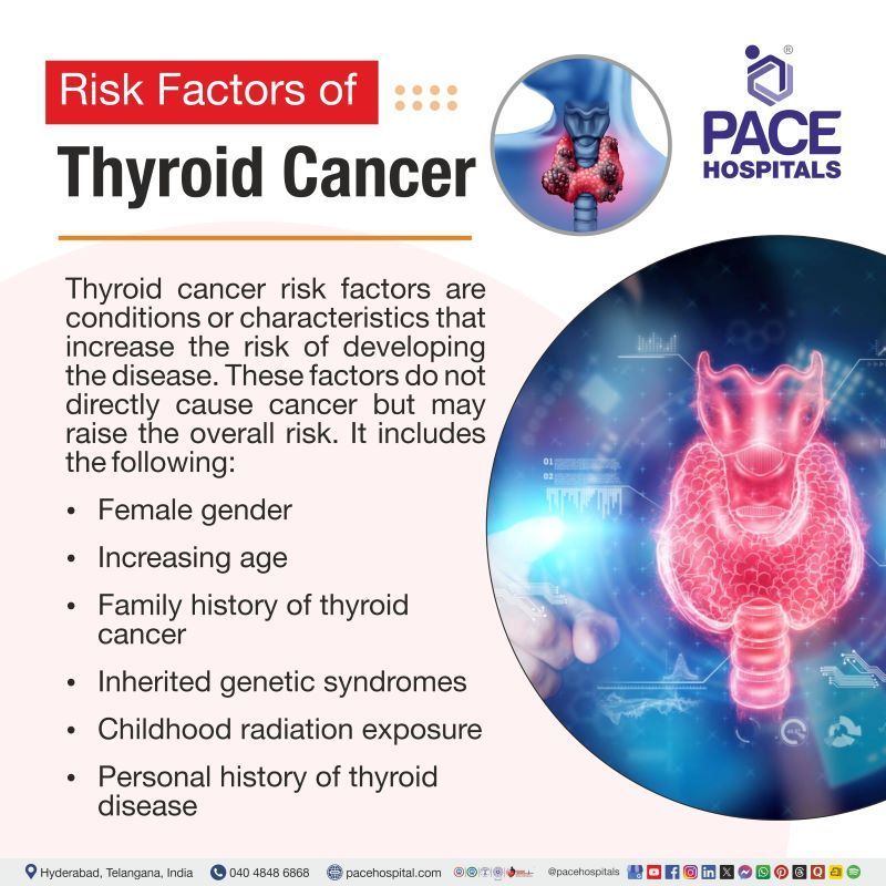 Thyroid Cancer Risk Factors | Risk factors for thyroid cancer