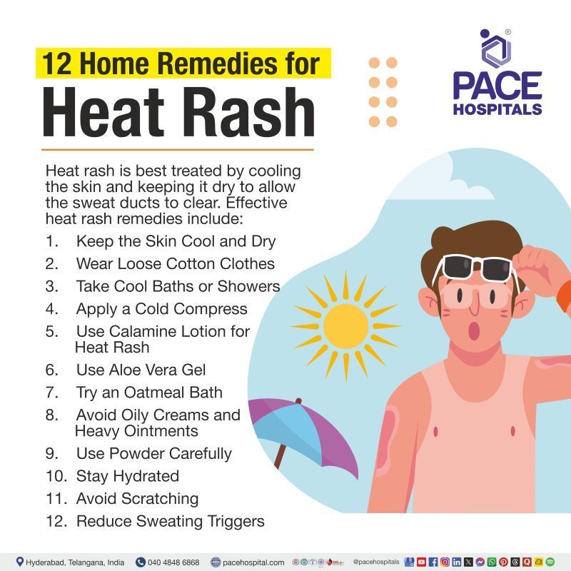 Home Remedies for Heat Rash Heat rash home remedies | Heat rash treatment at home | Summer skin care tips