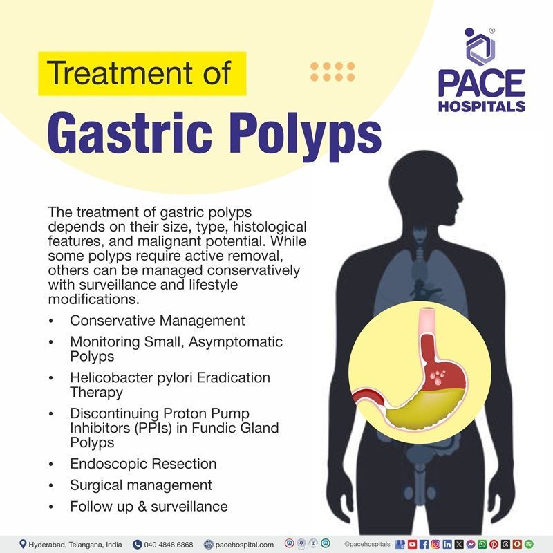 gastric polyps treatment​ | Visual suggesting the various gastric polyps treatment options