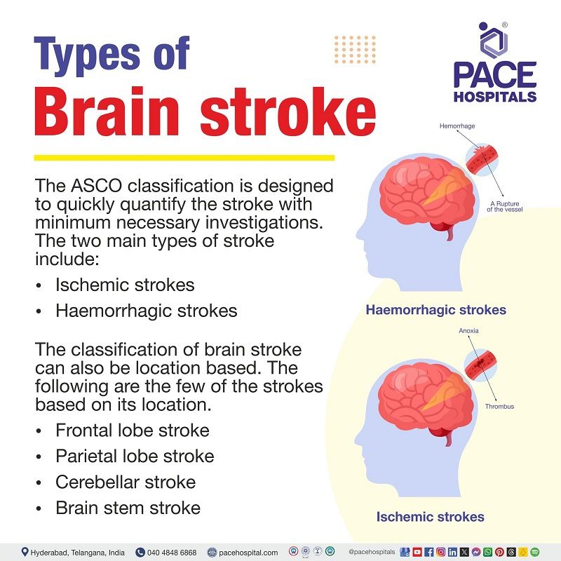 Different types of strokes in the brain | Types of Brain Stroke - Ischemic stroke and Haemorrhagic stroke | how many types of brain stroke | Visual showing types of Brain stroke