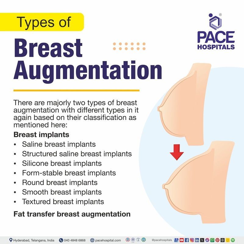 Breast augmentation types different types of breast augmentation | breast augmentation types | different types of breast augmentation procedures | Visual depicting the different type of breast augmentations