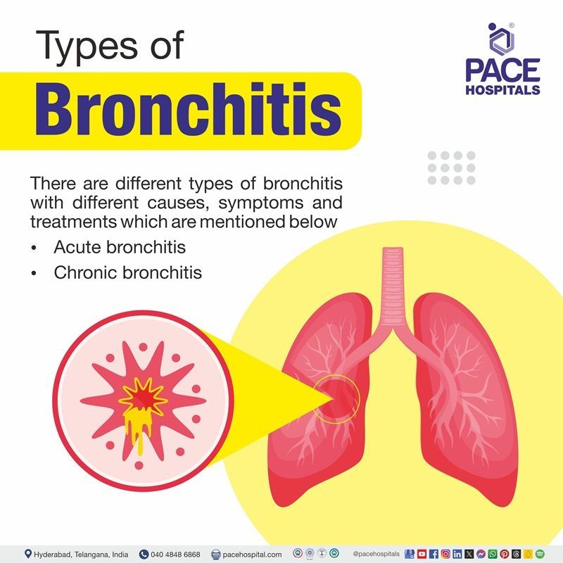 Types of Bronchitis Types Bronchitis | Different types of Bronchitis | Bronchitis types | Visual illustrating the different types of bronchitis