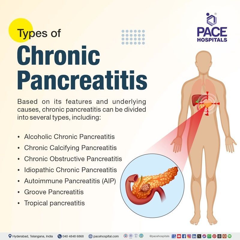 Chronic Pancreatitis Types | Visual depicting the various types of Chronic Pancreatitis