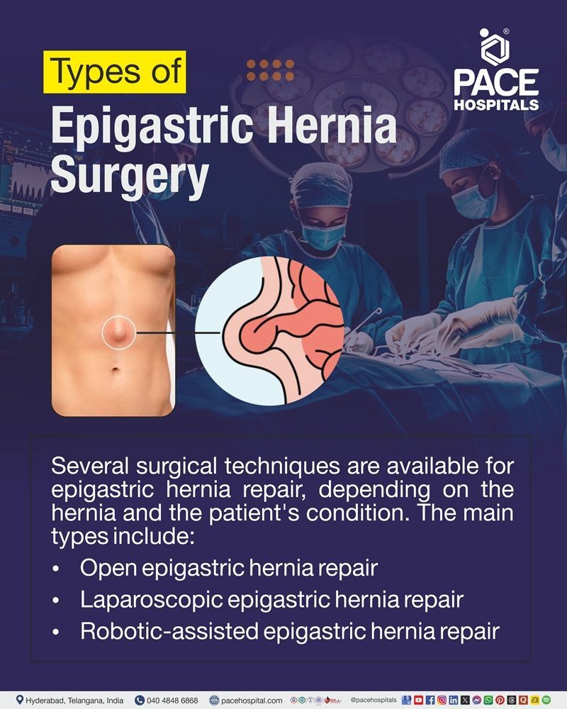 Types of Epigastric Hernia Surgery Surgical approaches for epigastric hernia repair, including open, laparoscopic, and robotic-assisted techniques.
