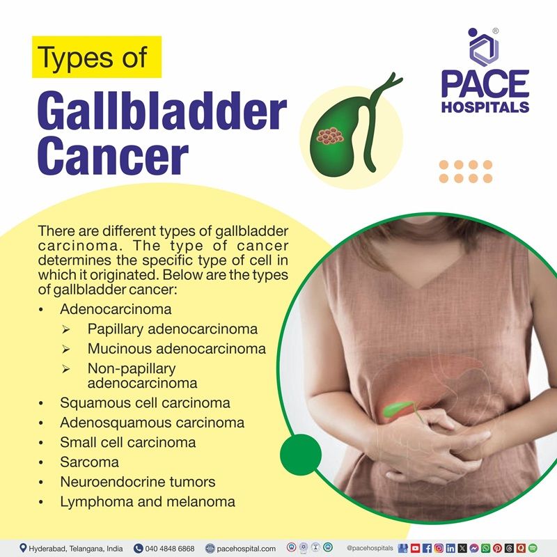 Types of gallbladder cancer Types of gallbladder cancer | Image showing the list of various gallbladder cancer types