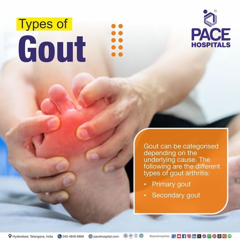 Types of Gout Types of Gout | Different Types of Gout | Gout Types
