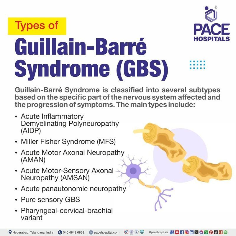 Guillain-Barré syndrome types | Image showing the various types of Guillain-Barré syndrome
