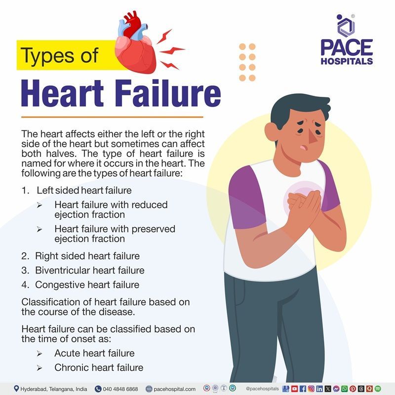 Types of heart failure Types of congestive heart failure | Image displaying the various types of Heart failure
