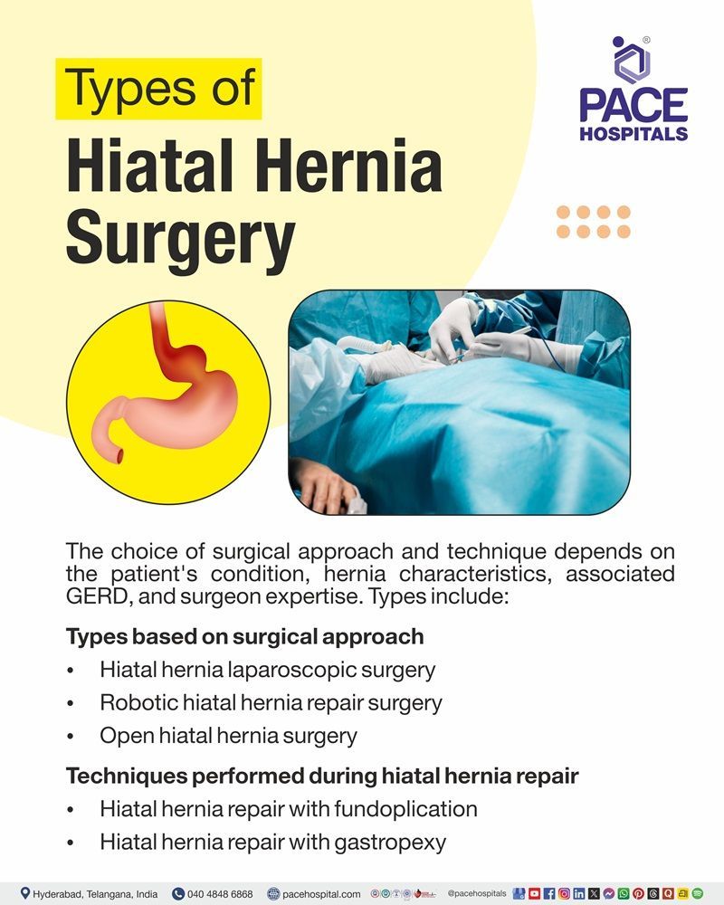 Hiatal Hernia Surgery Types Types of hiatal hernia surgery, including laparoscopic, robotic, and open repair with fundoplication and gastropexy.