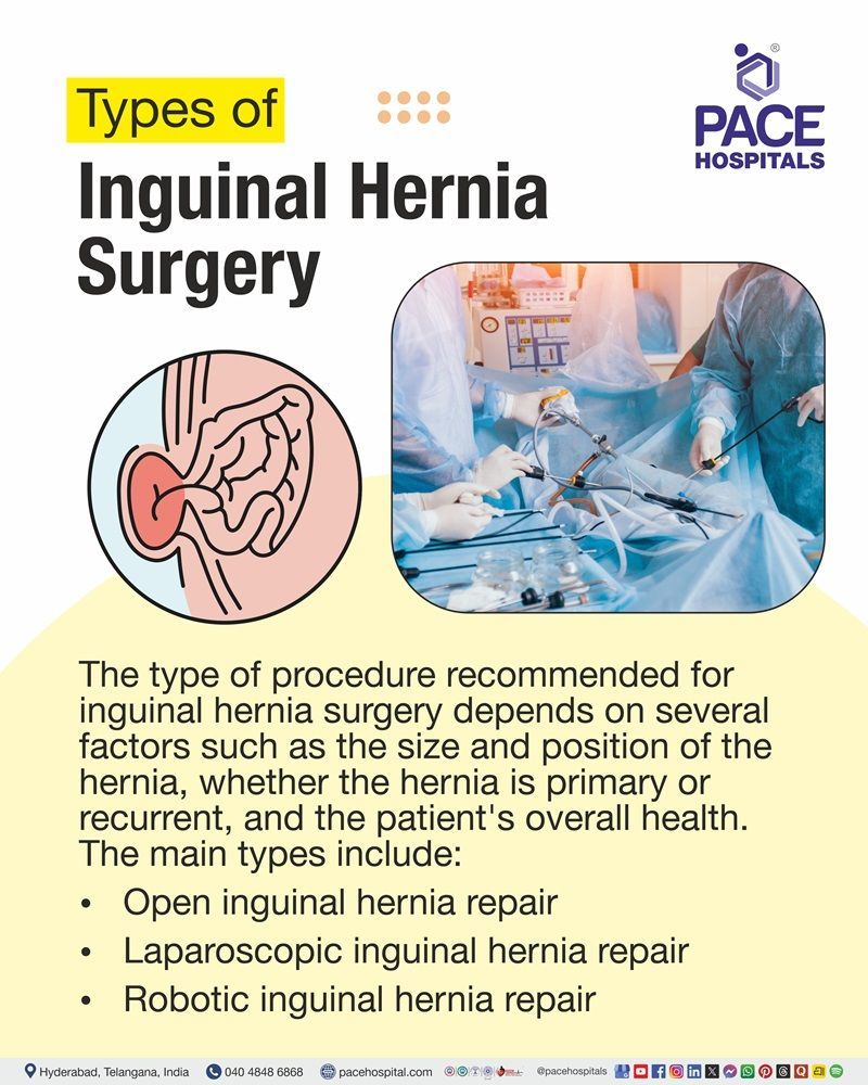 Types of inguinal hernia surgery, including open, laparoscopic, and robotic repair.