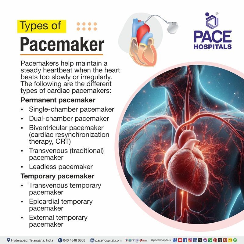 Types of Pacemaker Visual depicticting the different types of pacemaker based on requirement
