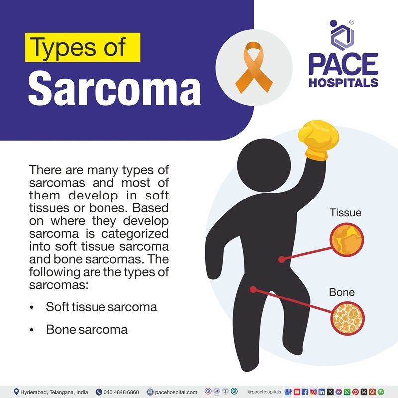 Types of Sarcoma Types of sarcoma | image showing different types of sarcoma cancer