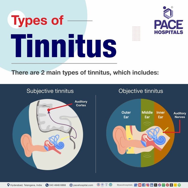 types of tinnitus | different types of tinnitus | tinnitus and its types | Visual showing the types of tinnitus | tinnitus types