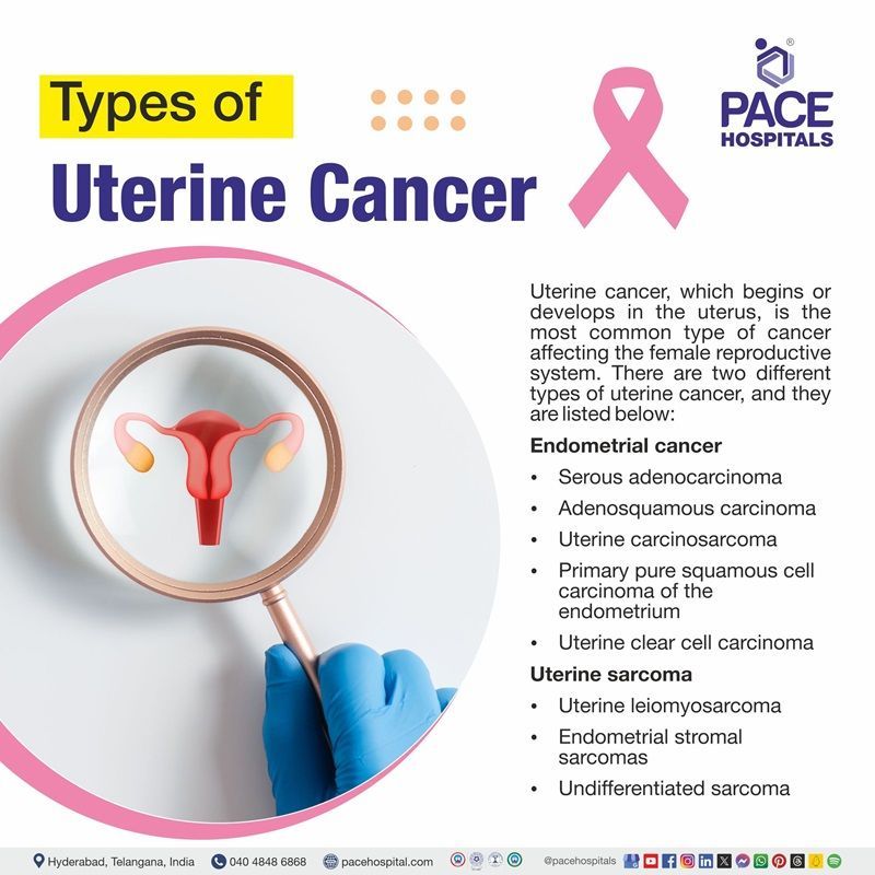 types of uterine cancer​ | uterine cancer types​ | type 1 uterine cancer​ | different types of uterine cancer​ | most common type of uterine cancer​