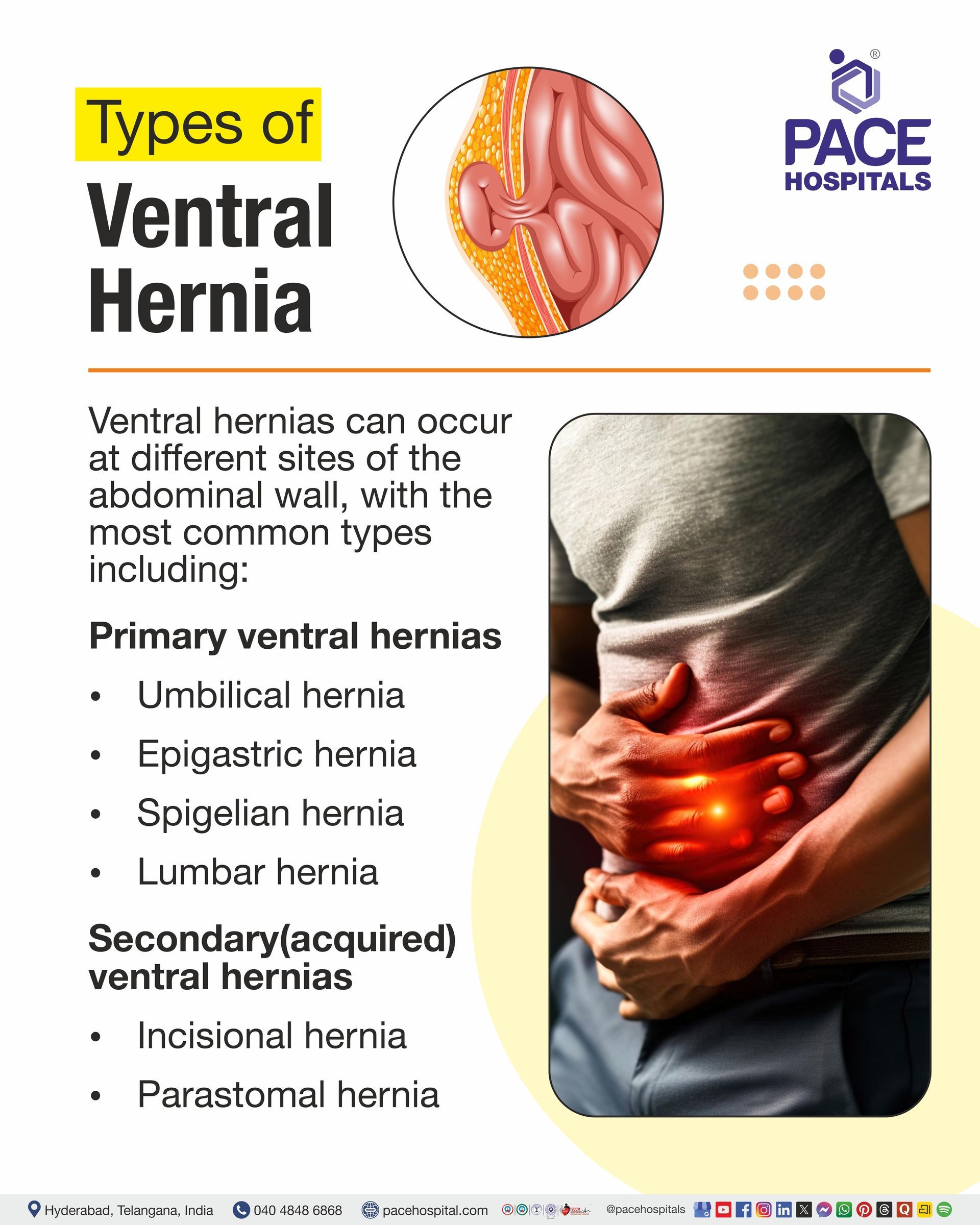 ventral hernia types I types of ventral hernia I types ventral hernia