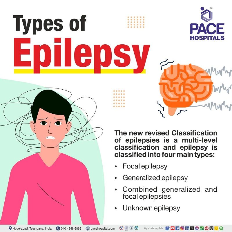 Epilepsy and its Types Types of epilepsy | Classifications of Epilepsy | Different types of epilepsy | Different epileptic conditions | Epileptic episodes and types | Visual elaborating revised classification of epilepsy and types.