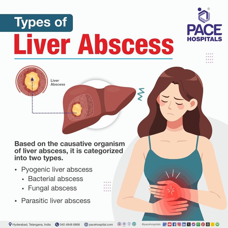 Types of liver abscess types of liver abscess | liver abscess | types | Visual out lining the various types of liver abscess | Pyogenic liver abscess | parasitic liver abscess