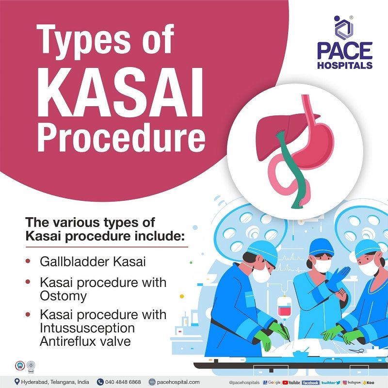 types of kasai procedure for biliary atresia types of kasai procedure | best hospital for kasai procedure in Hyderabad India | centre for biliary atresia kasai procedure