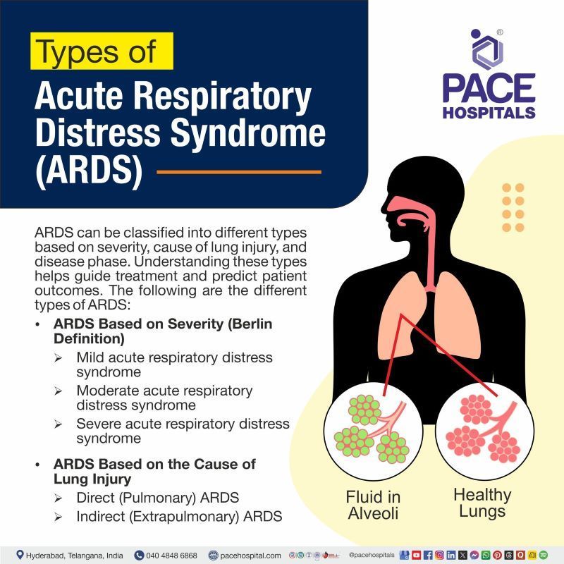 Types of ARDS Types of ARDS | ARDS type | Acute Respiratory Distress Syndrome Types
