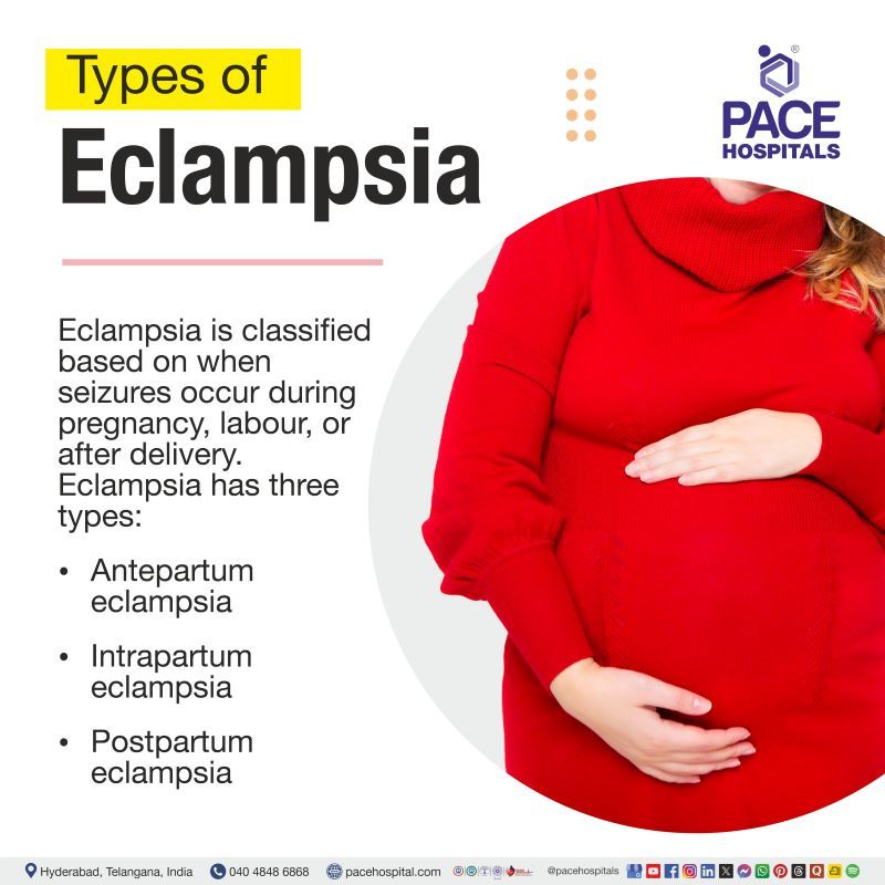 Types of Eclampsia Types of Eclampsia | Eclampsia Types