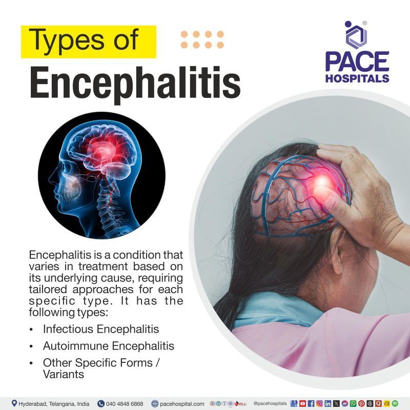 Types of Encephalitis Types of Encephalitis | Encephalitis rare types | Different types of encephalitis