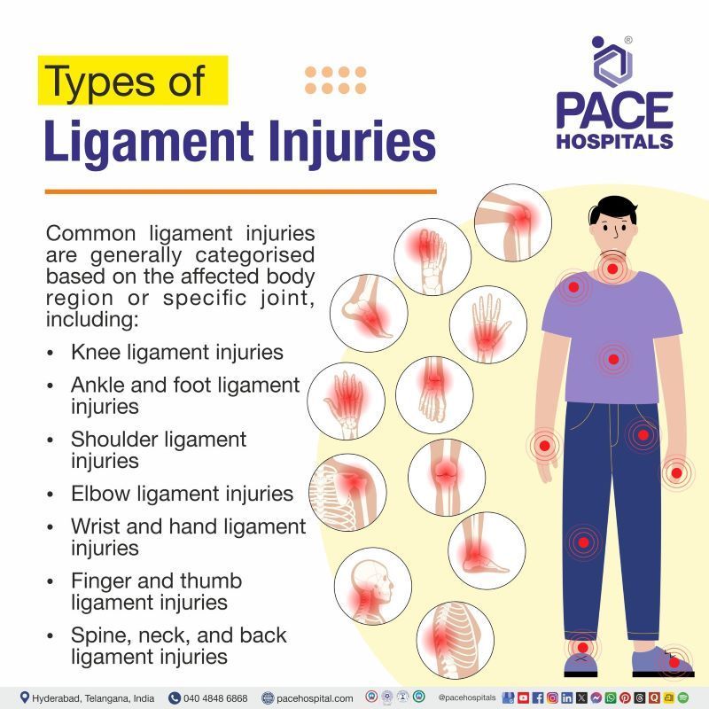 Types of Ligament Injuries | Ligament injury type