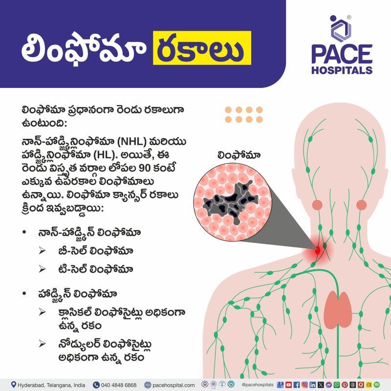 Types of Lymphoma in Telugu | లింఫోమా రకాలు | Lymphoma types in Telugu | Types of lymphoma cancer in Telugu