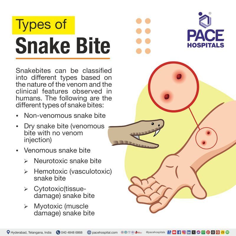 Types of Snake Bite Types of Snake Bite | Different types of snake bite | Snake bites types
