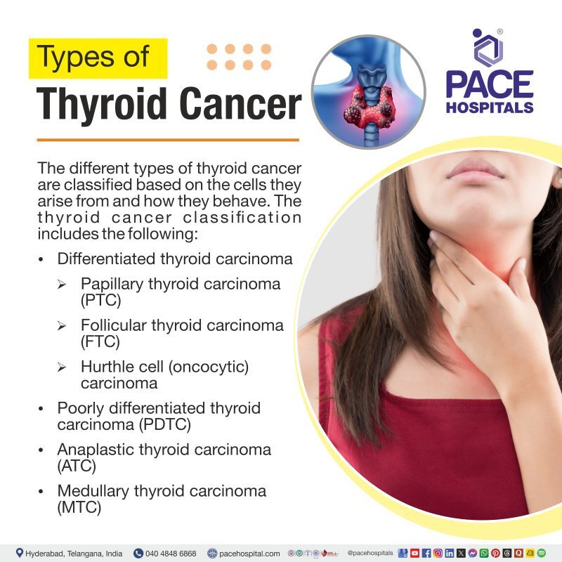 Types of Thyroid Cancer | Thyroid cancer classification | Different types of thyroid cancer