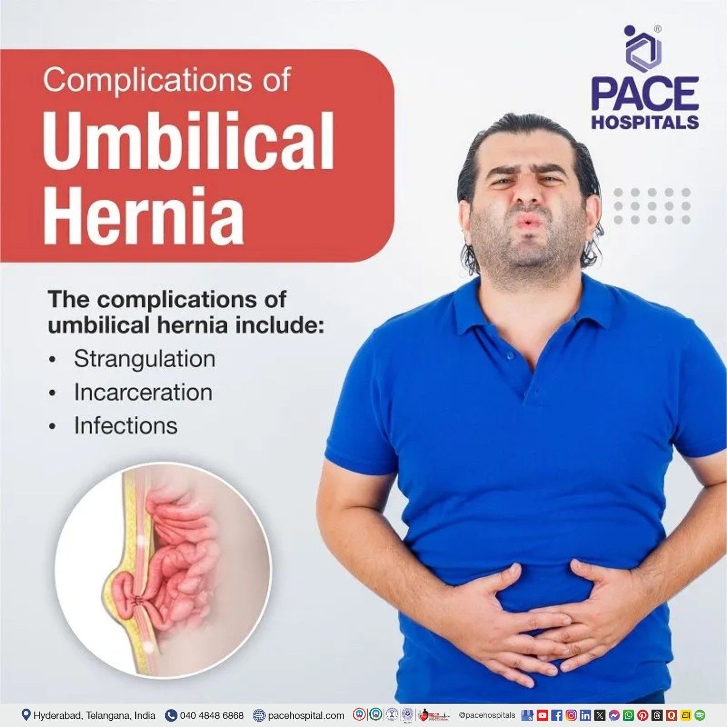 umbilical hernia complications, India | umbilical hernia risk | umbilical hernia strangulation risk | chances of umbilical hernia strangulation | umbilical hernia problems