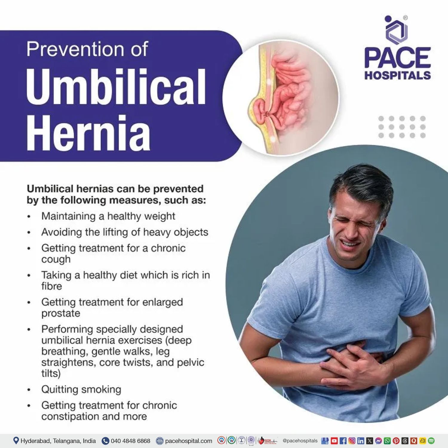 umbilical hernia prevention, India | how to avoid umbilical hernia | how to prevent umbilical hernia in newborns | umbilical hernia management | prevention of umbilical hernia