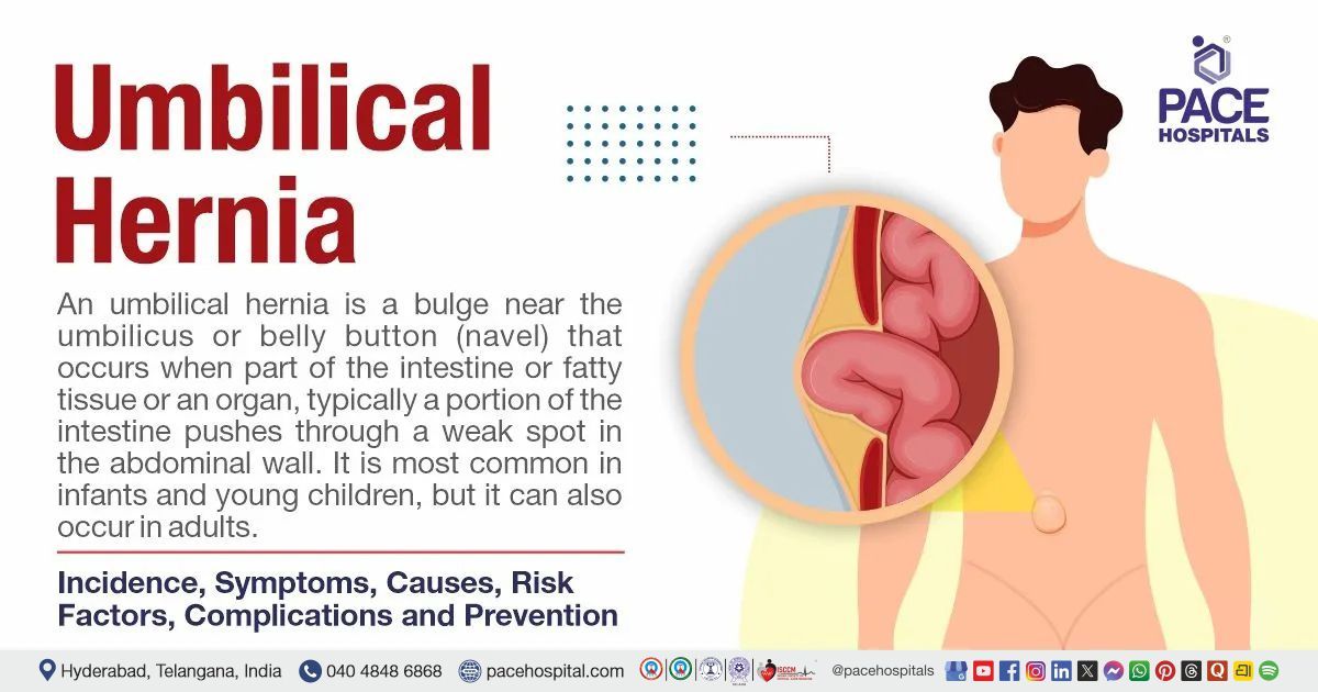 Umbilical hernia Symptoms, Causes, Incidence, Risk Factors, Complications and Prevention